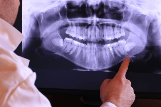 Best Emergency Treatment for Toothache in Anaconda, MT