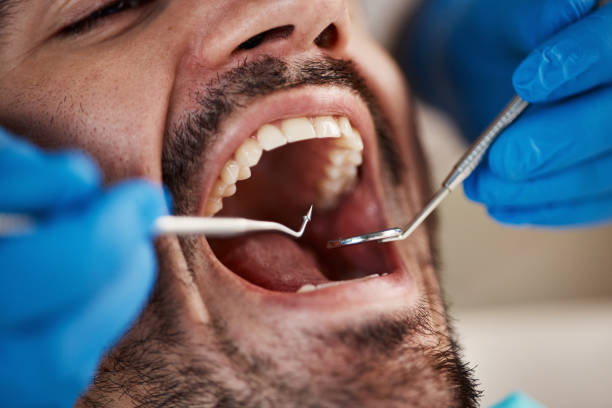 Best After-Hours Emergency Dentist in Anaconda, MT