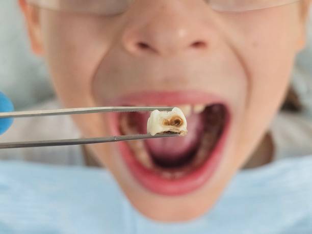 Best Emergency Treatment for Toothache in Anaconda, MT